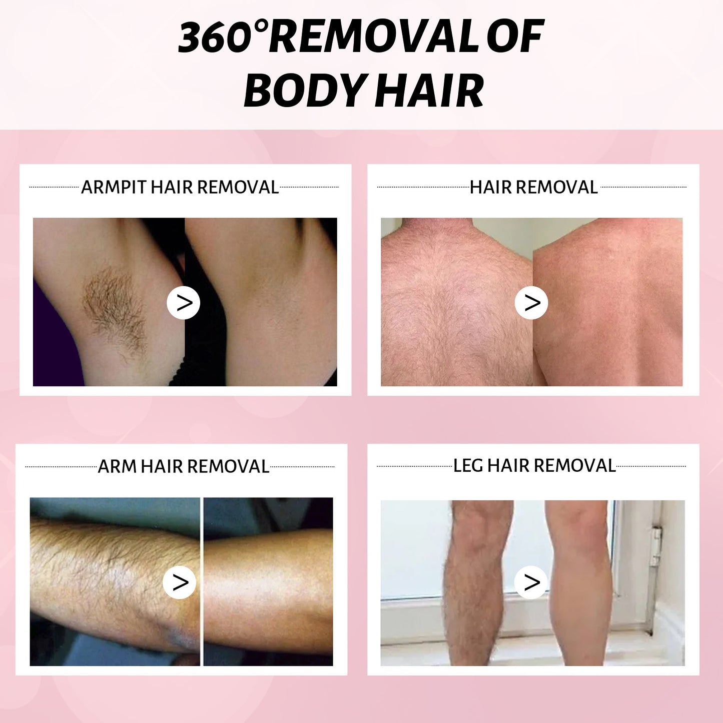 Hair Removal Spray Non-irritating